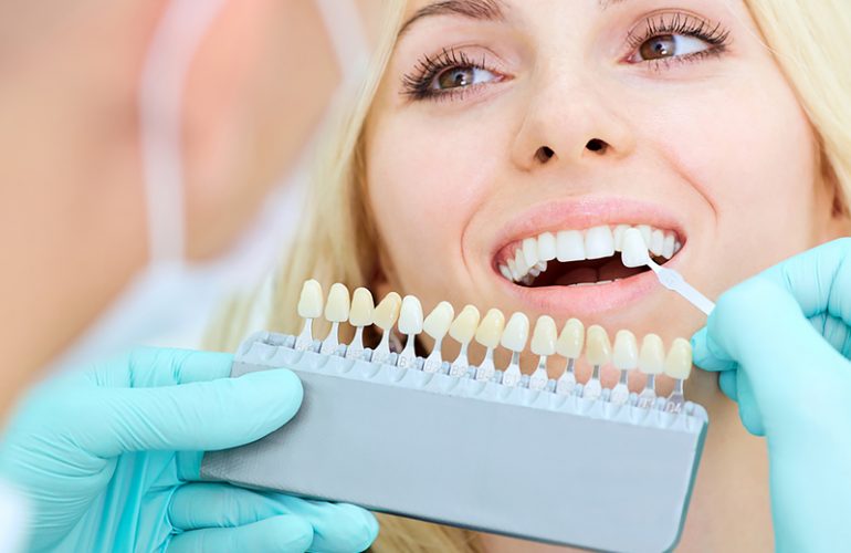 Teeth Whitening Vancouver